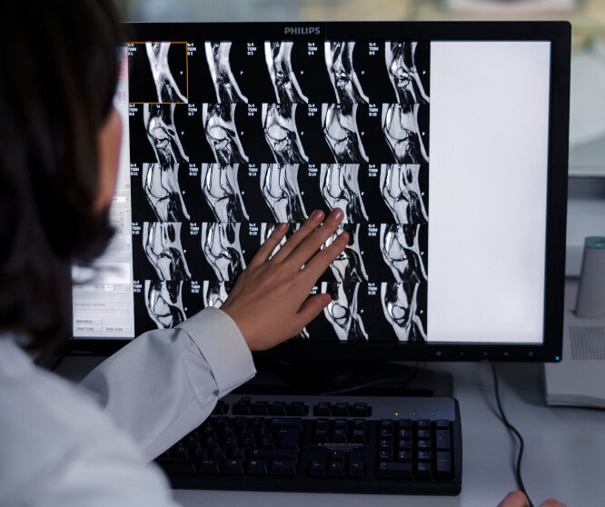 médecin regardant sur un écran les résultats d'imagerie médicale